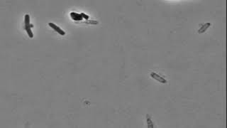 E. coli Cells Explode