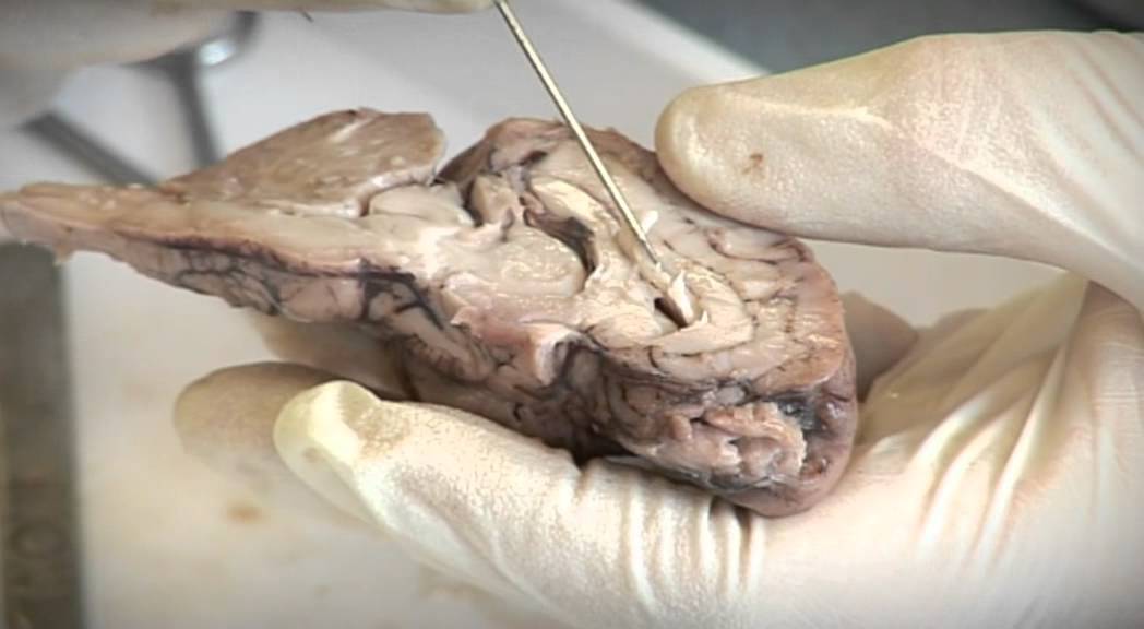 Sheep Brain Dissection - YouTube