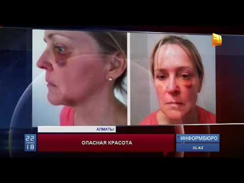 В Казахстане увеличилось число жалоб на косметологов В Казахстане увеличилось число жалоб на косметологов