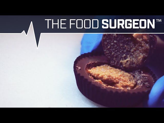 Reese’s Peanut Butter Removed With Oreo Cream Transplanted In It’s Place - Video