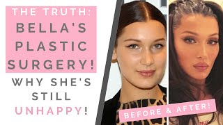 The Truth About Bella Hadids Plastic Surgery What To Know About Fillers & Botox Shallon