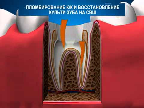 Лучшие стрижки на пушистые волосы Лучшие импланты для зубов: рейтинг имплантатов