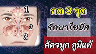 กด 3 จดน ชวยรกษา ไซนส คดจมก ภมแพ