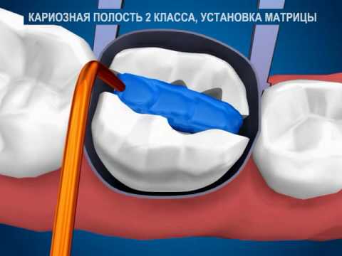 Контурная пластика кисетных морщин Как подстричь ногти собаке в домашних условиях: инструкция «Дай Лапу»