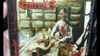 Watch Entrails Euthanasia video
