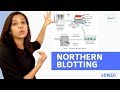 Northern Blotting | Basic Procedure | In Hindi