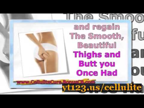 Best Cellulite Cream Allure - Foods To Help Reduce Cellulite - YouTube