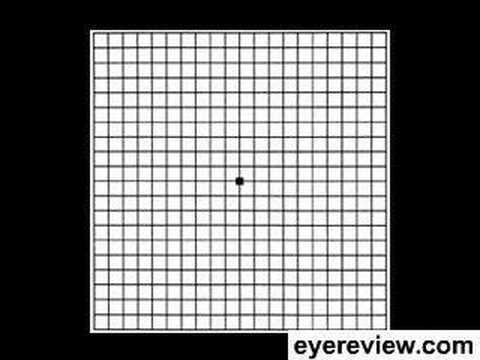 Grid for Macular Degeneration