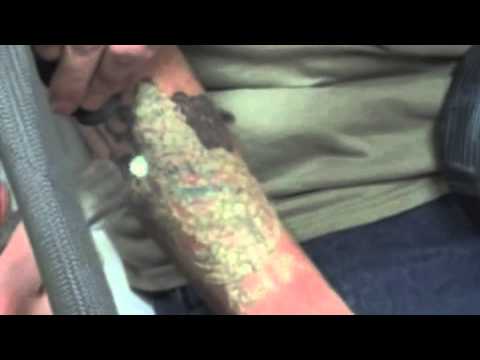 medlite videolike medlite videolike