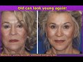Remove And Get Rid Of Laugh Lines: How To Look Younger Using Face Exercises