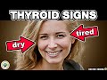 10 Urgent Signs Your Thyroid Is In Trouble