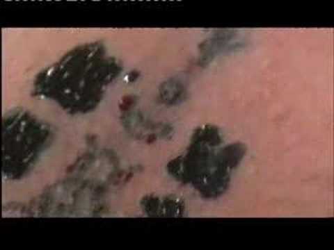 Video: Sak Yant Samnak Ajarn Noo Kanpai - Thai Khmer Tattoo Thailand Video: Sak Yant Samnak Ajarn Noo Kanpai - Thai Khmer Tattoo Thailand