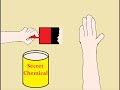 How Did Dynamo Do Burning Hand Trick Explained images How Did Dynamo Do Burning Hand Trick Explained
