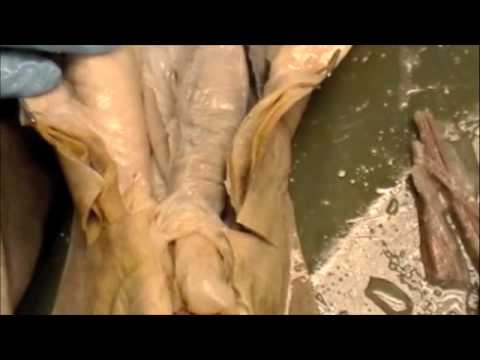 The external anatomy of a dogfish shark. The external anatomy of a dogfish shark.
