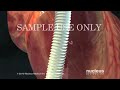 Nucleus Cardiology (Heart) Demo Reel