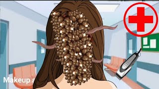 Asmr Treatment For Infected Wound And Maggot Removal From Red Girls Fec Hoods Feet Royalthakor07