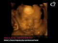 ultrasound 3d 4d
