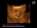 ultrasound 3d 4d