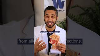 What Are Allergic Shiners?