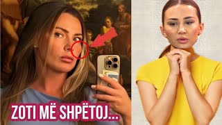 Zbulohet E Verteta Vuaj Prej Vitesh Nga Olta Gixhari Zbulon Të Vërtetën E Syrit