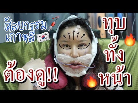 ไปศัลยกรรมที่เกาหลี!! ทุบหน้าใหม่ราคาเฉียดล้าน!!