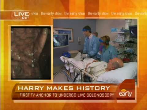 katie couric colonoscopy