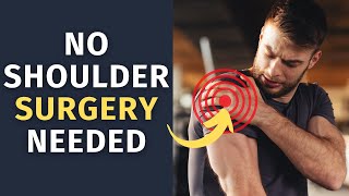 Treat Shoulder Impingement Without Surgery