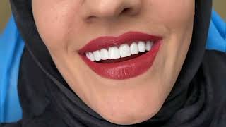 Females Teeth
