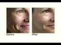 Artistry Time Defiance - Younger Acting Skin