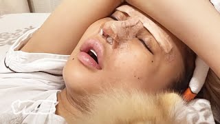 Why Kids Are Getting Plastic Surgery In Japan