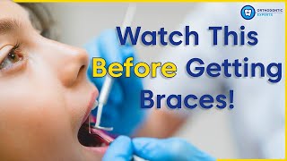 Watch Braces 8 video