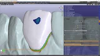 B4D Crown Module