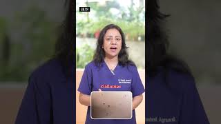 Mole Removal Procedure Dr. Rashmi Agrawal Explains How Its Done Safely & Effectively
