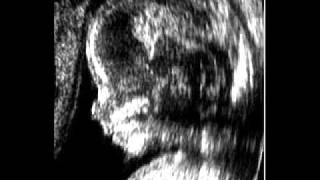 Watch Harm Embryo video