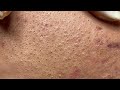 Satisfying Hien Spa Beauty Relaxing Video #28