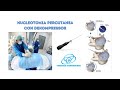 Discectomia percutanea Lumbar Y Discolisis Cervical