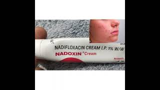 Nadifloxacin Creami.p.1%Ww Nadoxin Cream