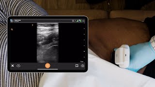 Hip Injection For Pain Management