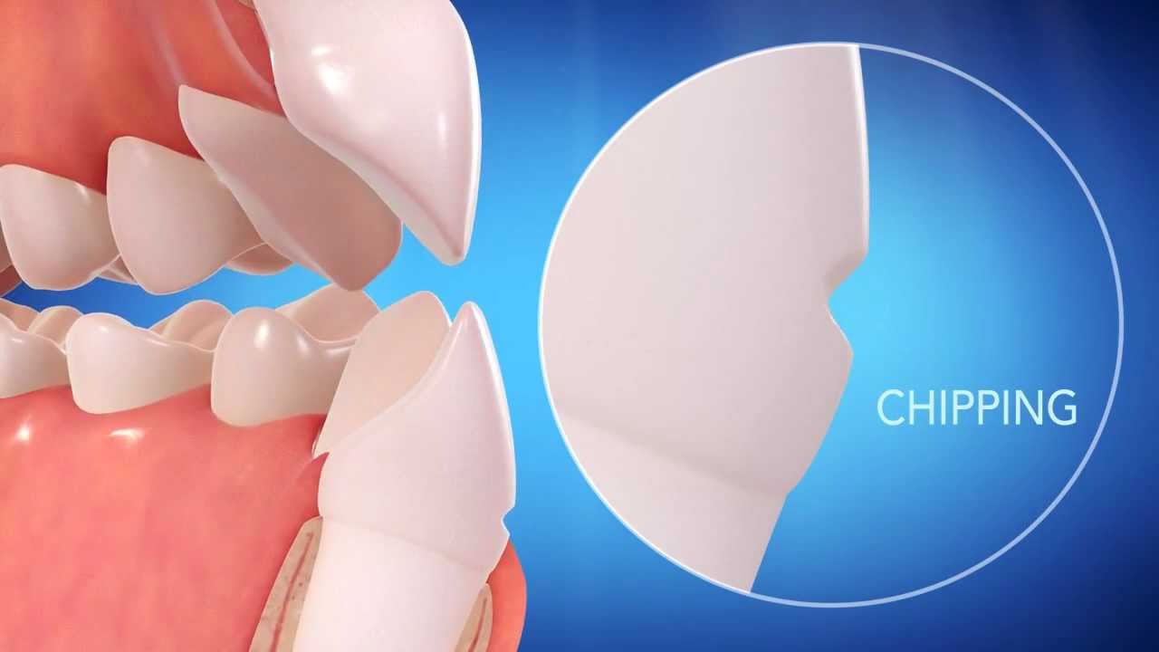 Metlife orthodontic insurance for adults