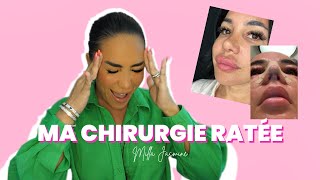 Milla Jasmine Ma Chirurgie Ratée