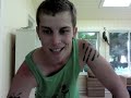FTM Top Surgery - 3.5 Years post-op showing!