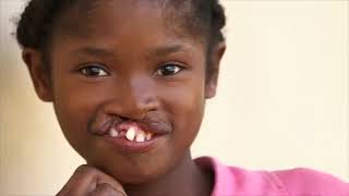 Russ Reid Operation Smile Nicaragua. Madagascar. Philippines.