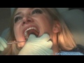 dental fetish