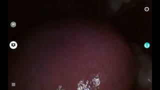 Giantess Lili Stomach Tour
