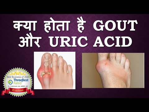 Gout and Uric Acid (Hindi)