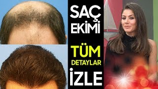 Saç Ekimi Nasıl Yapılır? - Tüm Detaylar Neslihan Uğurla Rengarenk