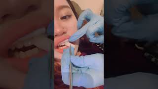 Key Perawatan Gigi