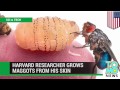 Maggot infestation: Harvard researcher Piotr Naskrecki grows botfly larvae in his skin