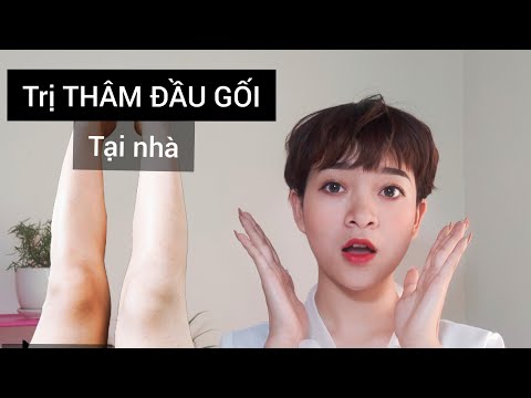Cách LÀM TRẮNG ĐẦU GỐI, KHUỶU TAY ngay tại nhà. | Góc làm đẹp | Quỳnh ơi