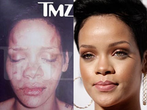 rihanna injury